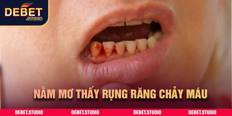 Nằm mơ thấy rụng răng chảy máu
