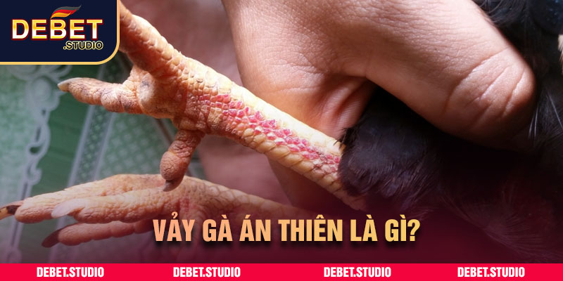 Vảy gà án thiên là gì?